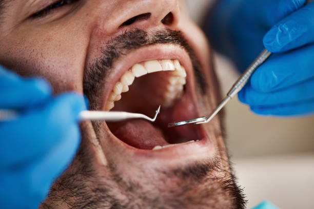 Best Sedation Dentistry  in Scissors, TX